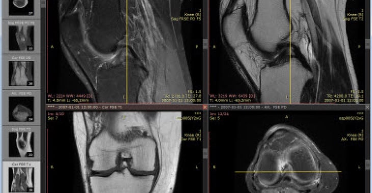Medical images and details of 24.3 million patients left exposed on the internet